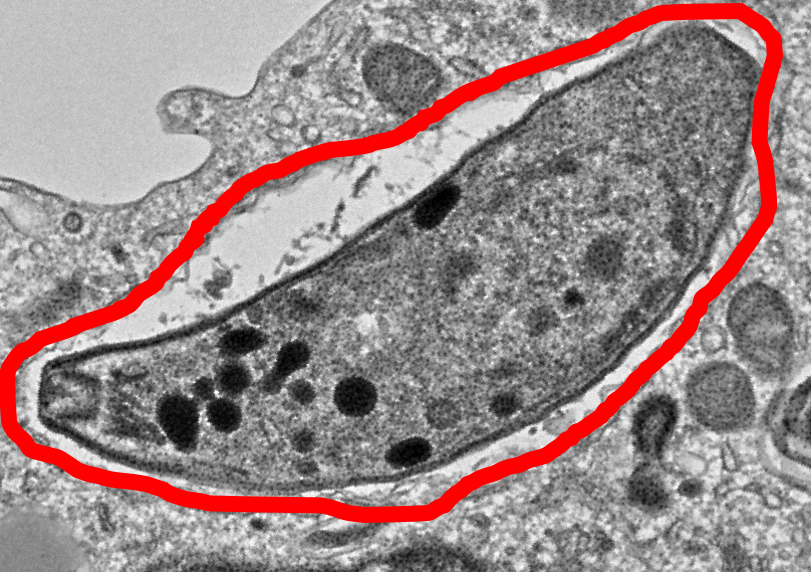 トキソプラズマの寄生胞とその膜